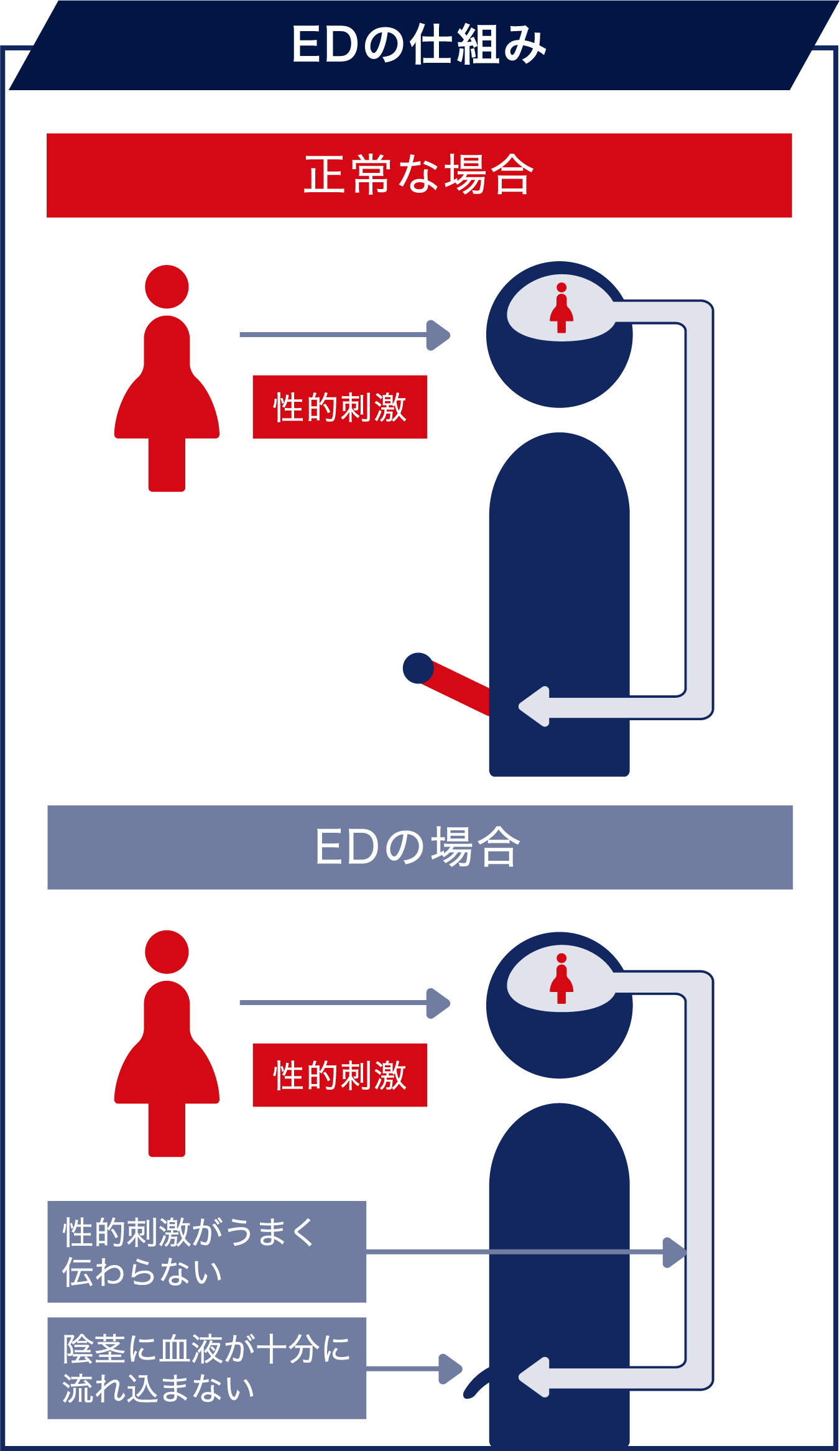 EDの仕組み