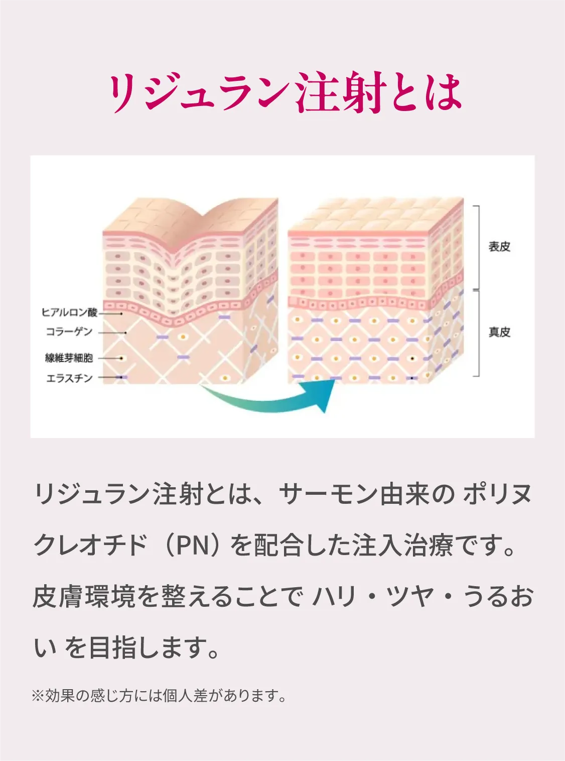 リジュラン注射とは