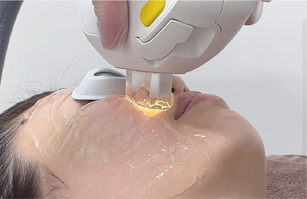 フォトフェイシャルをでお得に体験させていただきました。