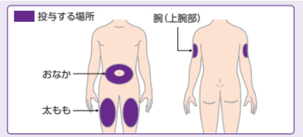 マンジャロの使い方