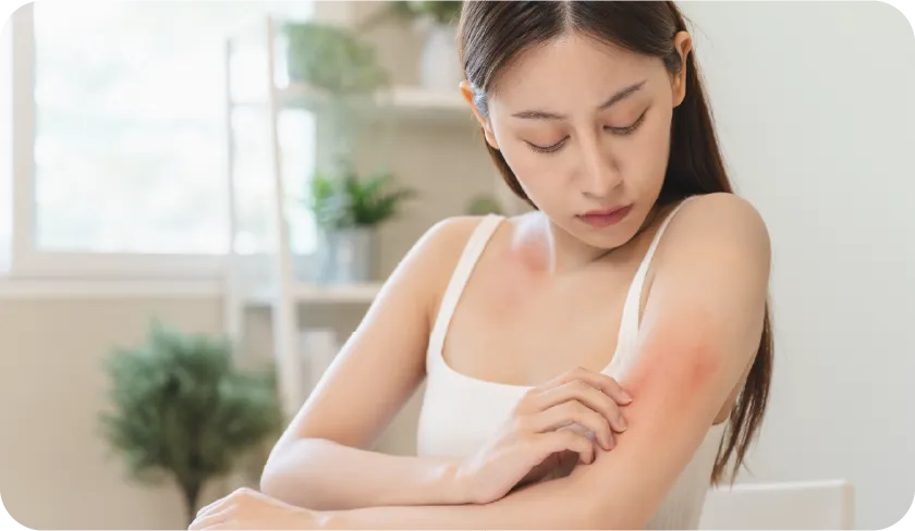 アレルギー反応