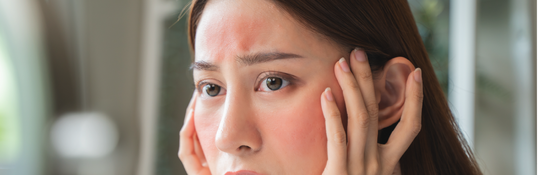 赤み(炎症後紅斑)