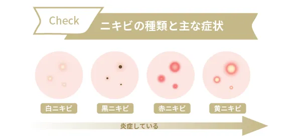 【段階・種類別】ニキビ跡を作らないための対策