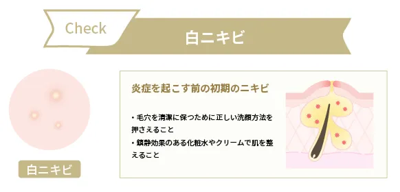 白ニキビ