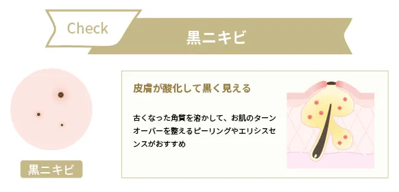 黒ニキビ