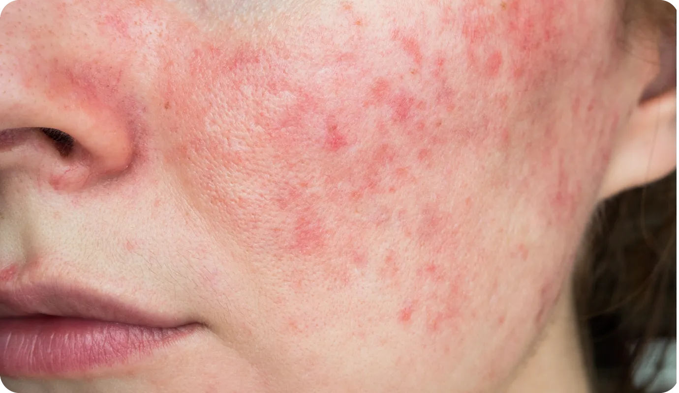 症状が強いときは再診を検討する