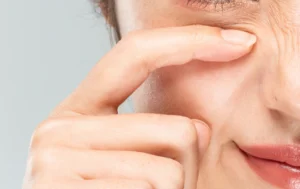 目元まで治療可能