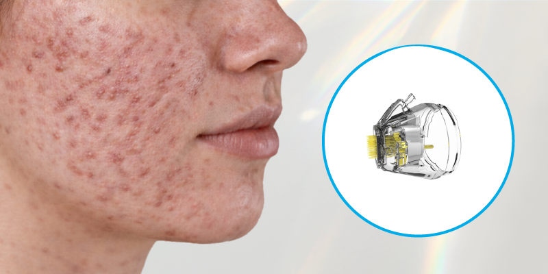 違い2痛み・施術時間