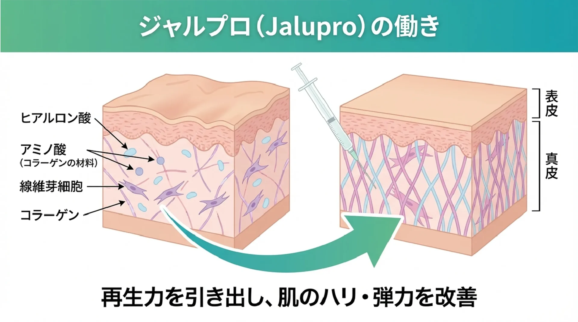 ジャルプロスーパーハイドロとは?